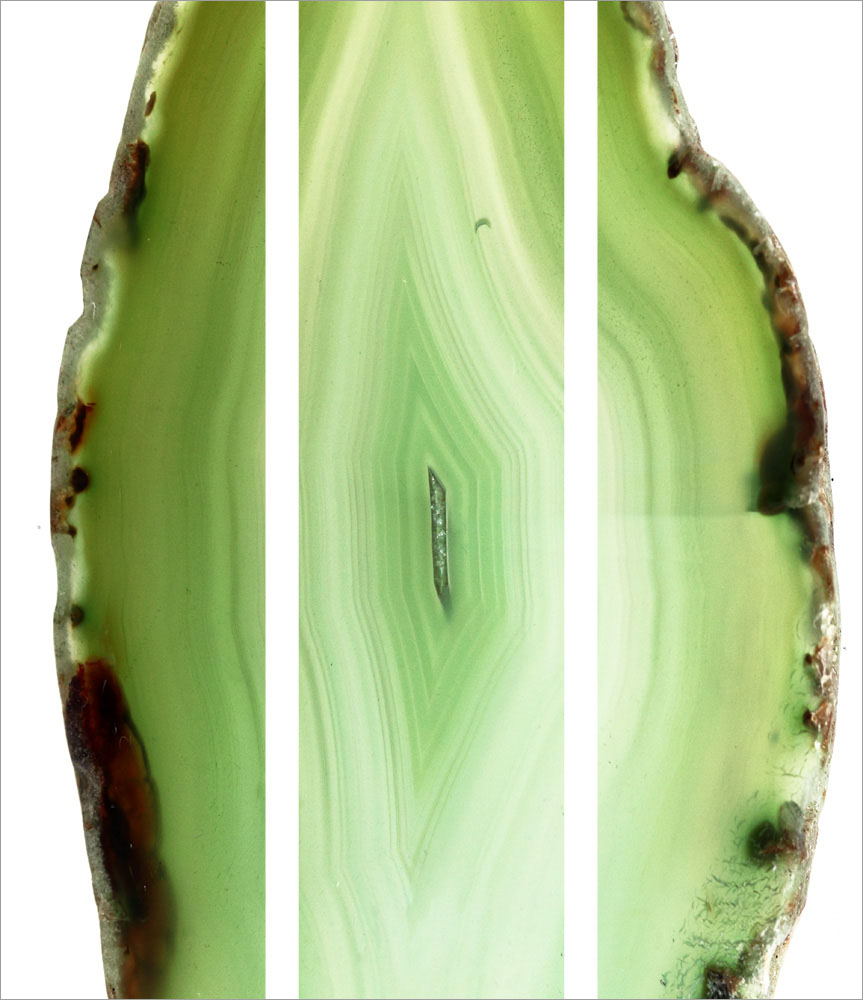 AL01104