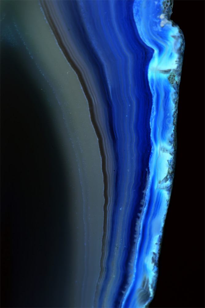 AL01125