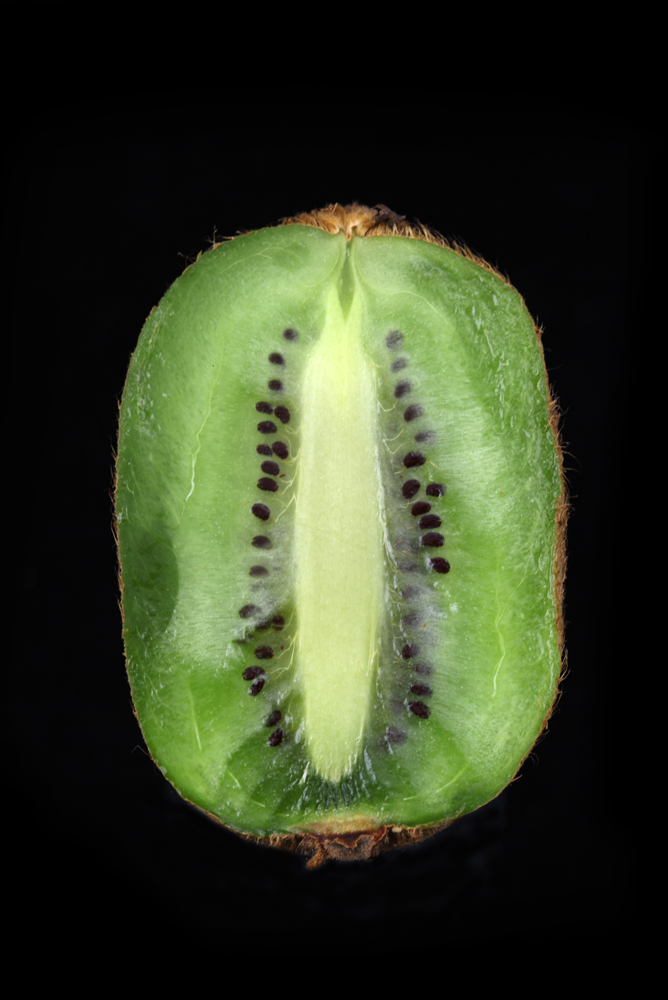 AL01560
