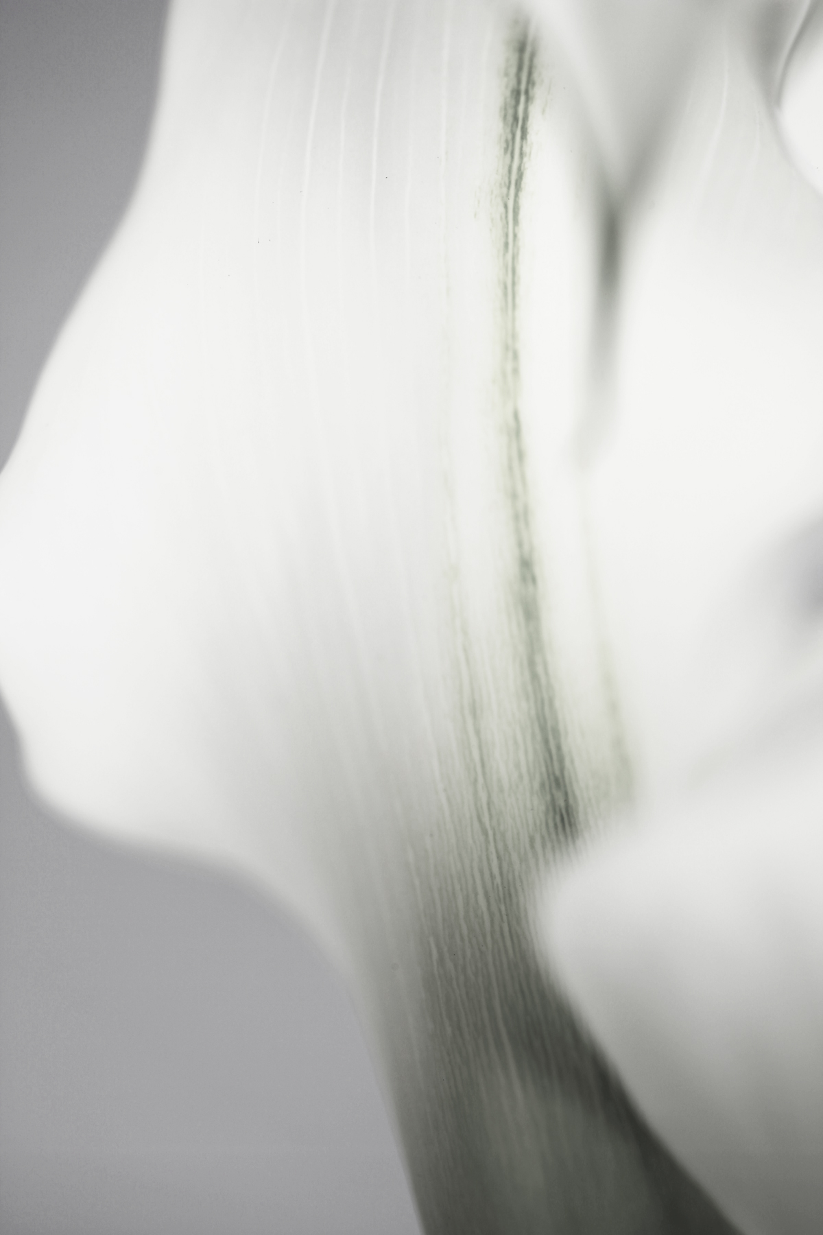 AL05304